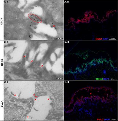 Electron microscopy of desmosomal structures in the pemphigus human skin organ culture model